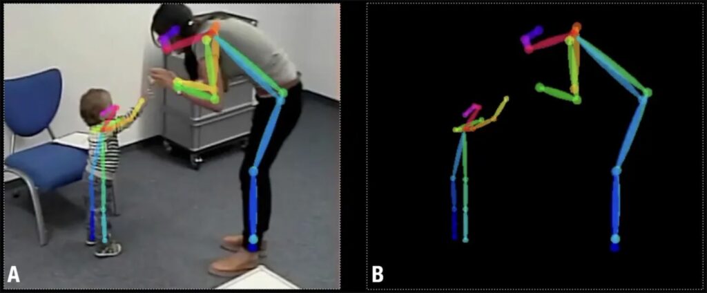 Détecter l'autisme grâce à la vidéo